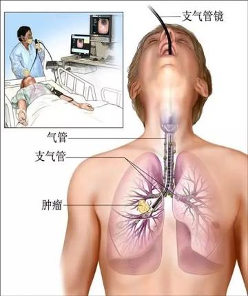 bd56999c-36b5-4dbb-abe9-f56750083a88.jpg bd56999c-36b5-4dbb-abe9-f56750083a88.jpg