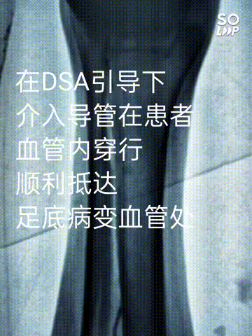 动图.gif 动图.gif