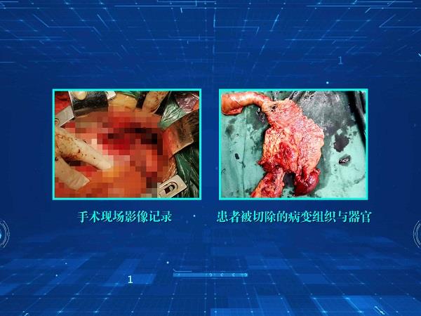 两图和一起(网站).jpg 两图和一起(网站).jpg