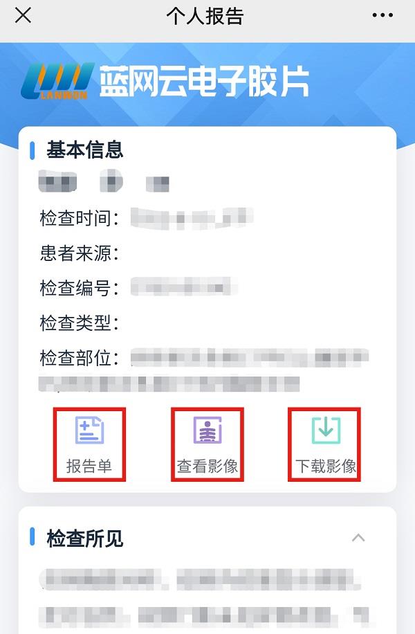 在个人报告中可以进行查看报告单、影像以及下载影像等操作 在个人报告中可以进行查看报告单、影像以及下载影像等操作.jpg