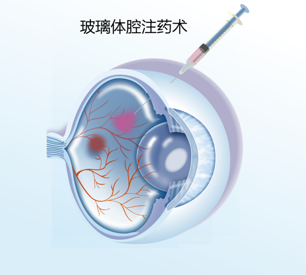 图片2(网站版) 图片2(网站版).png