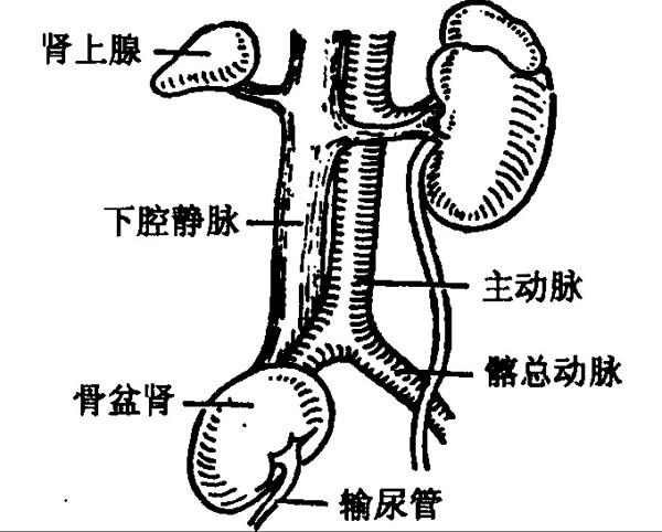 异位肾 异位肾.jpg