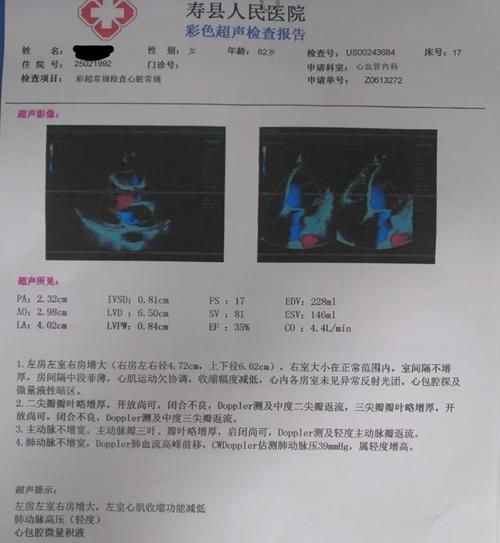 心脏超声_副本.jpg